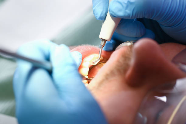 Best Pediatric Emergency Dentist in Hammond, LA